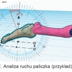 Rys. 2. Analiza ruchu paliczka (przykład)